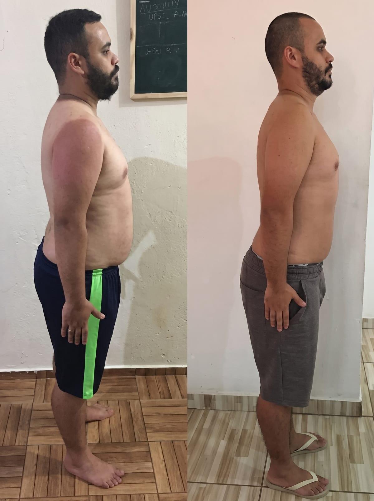 Beto de perfil, antes e depois do acompanhamento com o Marcelo